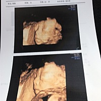 22周的四维彩超，有没有经验的准妈妈可以看出男女麽？