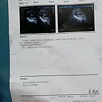 朋友们  帮忙看下   这是女宝  男宝？谢谢了