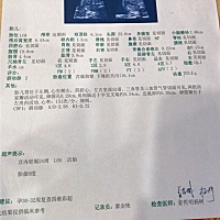 24周多了，四维也照了，安心度过了六个月，医生说我的宝宝有点偏大，第一次看到宝宝的五官，虽然不是很...