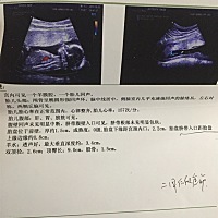 大家能看看男孩女孩吗 有NT和四维的单子