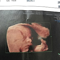 23周做的四维，觉得像男孩还是女孩呢