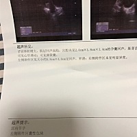 怀孕40多天 到医院彩超说左附件有囊性包块 有5.8cm *4.0cm 好担心 有宝妈有过类似情况的吗