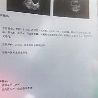 医生说长的不理想，有没有懂的帮我看看。这三周经历