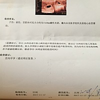 大家帮忙看下 怀孕2个多月了  还没有胚芽组织 ，医生说没用了，