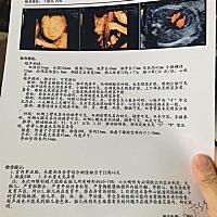 有谁会看男女宝宝，麻烦帮忙看一下