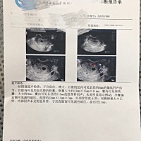 大家怎么看？医生不看好，说胚芽那么长了还没有胎心不正常，要做好准备。现在是孕52天。