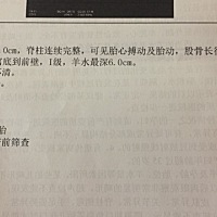 今天去检查，本是24周，通过看这个B超医生说孩子太小，这个数值是22周孩子的大小！真的就这么小吗？