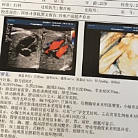 有人会看吗？好想知道宝宝的性别，会看的麻烦通告一声谢谢你!