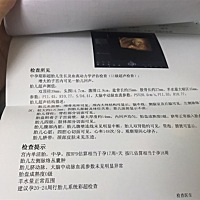 昨天刚做的羊水穿刺，愿好孕！