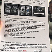 哪位大神帮我看一下是男孩还是女孩呀！特别想要个女儿