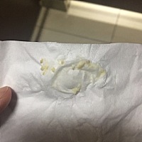 这段时间一直分泌的是这种，有人能告诉我一下这是怎么了吗，需要去医院挂什么科