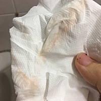 上午因为便秘使劲拉了大号，下午就这样了，实在不放心去了医院，医生说没事，可是心里还是担心，有和我...