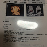 好奇男女能看得出来吗？不是重男轻女