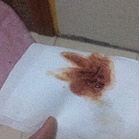 末次月经11月27号开始20号结束12月1号开始出血昨天测hcg84.96然后现在还在出血怎么办