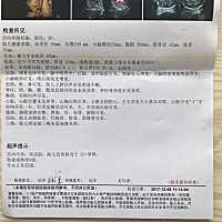 今天做了期待已久的四维  第一眼看了怎么这么丑😄 亲们看看这是男宝女宝