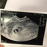 前天下午突然出现了深褐色的分泌物，昨天早上去了医院，医生说别担心，这些是以前还没有排干净的血，他...