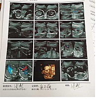 帮看看是男宝还是女宝？头胎，好奇