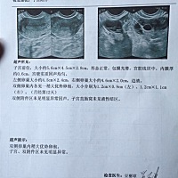 是不是有双胞胎的可能？