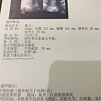 好担心又是低置胎盘，生老大的时候也是这种情况，希望可以正常了🙏