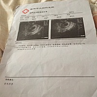 做了四次检查。。。唐筛结果不知道。。说打电话就是有问题，没打电话就直接去拿。。。到现在快一个月了...