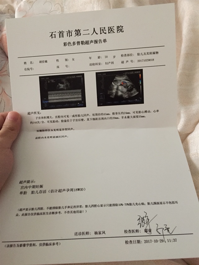 医生让我20天后去医院，我就去了。我妈让我不要每个月都去医院，这是我回家一个月，要结婚了去医院做个检查，才知道四个月要做唐筛。。唐筛在我老公那边做的。。