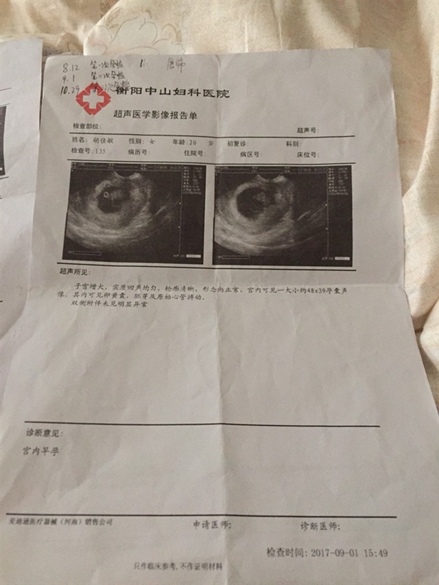 大姨妈一般会提前几天来，这次没有，以为是胃不舒服，去小诊所，让我测一下，怀孕了。第二天就去大医院检查了。