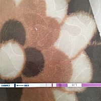 姨妈推迟三天了，今天中午用排卵试纸测出来的，请问这是什么情况？之前用早孕试纸测过，当时是白板，但...