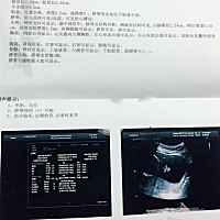 孕24周的三维B超，看着像男孩还是女孩啊？