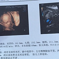 有看的懂的亲们吗这是男宝还是女宝啊