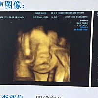 今天做的四维，看着宝宝在里面吐舌头，萌死了！好期待他的到来！