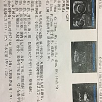 各位宝妈帮我看看是公主还是公子😃😃                           猜对有大奖，谢谢🤗🤗🤗