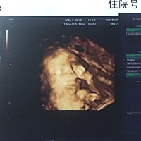 这面相像是男孩还是女孩啊，好喜欢女孩，但感觉嘴唇和鼻子像我，好怕是个男孩😢你们看像👦🏻还是...