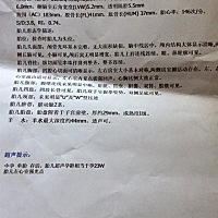 谁会看四维彩超判断男女啊