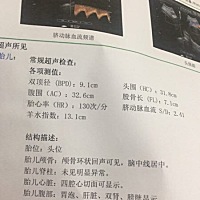 孕妈们帮忙看看现在这数据，宝宝大概多少斤呢？