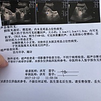 谁会看啊？是不是很不好？没有胎心