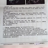 纯属好奇哦，现在6个多月了，大家来看看我家宝宝是男宝女宝呀，其实我觉得最重要的就是宝贝健康就好，现...