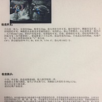 大家来帮看看～根据数据的显示，是女宝还是男宝？宝宝左心室有小强光斑，医生建议去做胎儿心脏彩超。有...