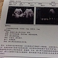 社会会看是男是女呀！