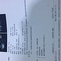 医生怀疑胎盘帆状，胎盘后，又怀疑胎盘早剥 .....