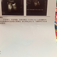 各位亲们帮我看看男孩女孩吧？