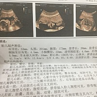 麻烦帮我看下男宝女宝 谢谢
