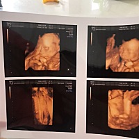 男宝还是女宝各位宝妈帮忙看下呀^ _ ^