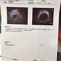 有会看的大神么，好想知道是男宝宝还是女宝宝呀。谢谢谢谢🙏。