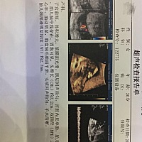 请各位高手看一下男孩女孩，谢谢大家了！