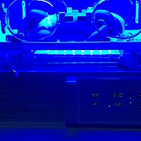 宝宝蓝光治疗  好心疼   希望快点好起来  回家