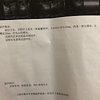 懂的亲帮看看是男宝女宝🙏🏻🙏🏻🙏🏻