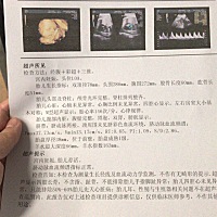 三维B超单，求哪位大神会看男女的，帮忙看一下！