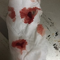 怀孕六个月尿道出血还有血块，宝妈有种情况的吗