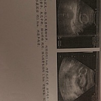 有没有人会看这是男宝还是女宝🤓