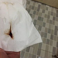 请问各位美女，这是受精卵着床之后出血吗？